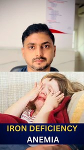 1.5M views · 79 reactions | ** Iron Deficiency Anemia in Children:...