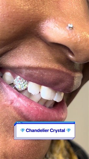 Tooth Gems by Chandelier Crystal in Johannesburg