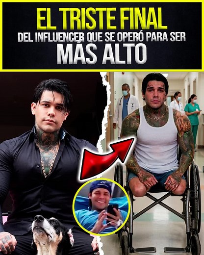 Alargamiento de piernas de Jefferson Cossio: así fue su triste final