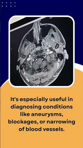 Magnetic Resonance Angiography (MRA)