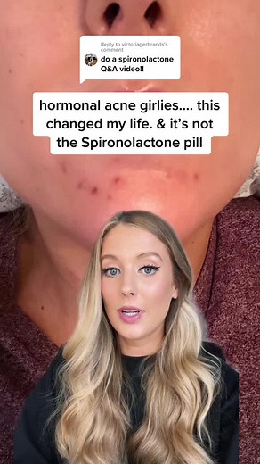 Replying to @victoriagerbrands #hormonalacne #hormonalbreakouts #spironolactone #spironolactonejourney #greenscreen