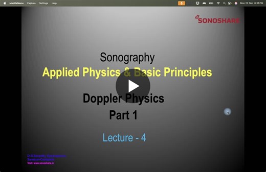 Describes physics of Doppler Effect, shift, angle, modes, flow patterns, artifacts, aliasing and convention followed. Posted on 25/12/2020 | DR BOOPATHY VIJAYARAGHAVAN