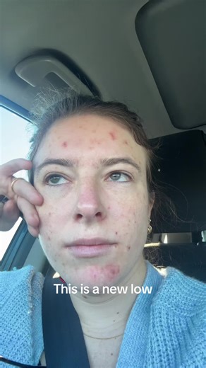 Unexpected Skin Picking Encounter