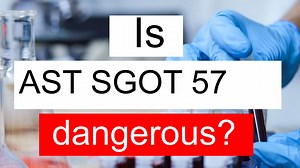 Is AST SGOT 57 high, normal or dangerous? What does Aspartate aminotransferase level 57 mean?