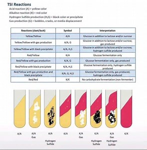 279 reactions · 36 shares | The Triple Sugar Iron (TSI) agar test is...
