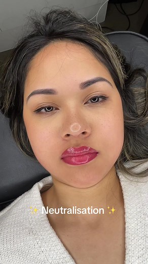 Dark Lips Treatment: Neutralization Techniques Explained