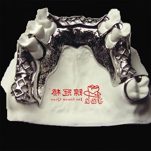 [Hot Item] Customized CNC Milling Metal Bracket for Removable Partial Dentures with Co-Cr or Titanium Alloy From China Dental Lab