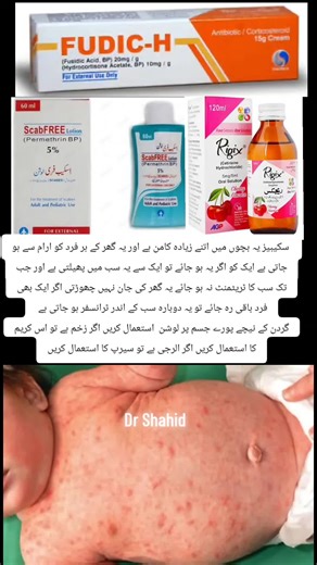 Understanding Scabies in Children: Causes and Treatments