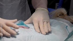 Doctor testing if the local anaesthetic is working before the surgery.