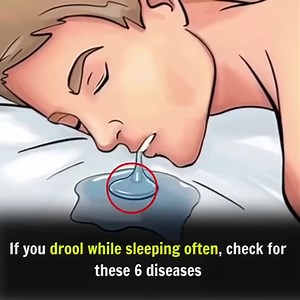 1.1M views · 973 reactions | This is more serious than you think!  | Break | Facebook