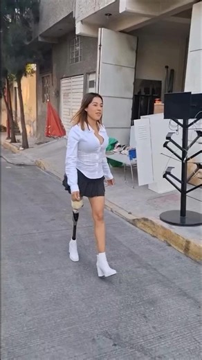 Above Knee Amputee Girl Walking Confidently | Inspirational Prosthetic Leg Journey in Park