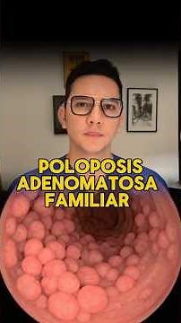 Familial adenomatous polyposis increases the risk of colon cancer. #medicine #healthtips