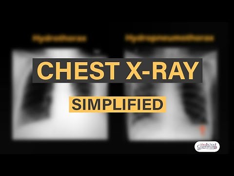 How to read a Chest X-Ray| Radiological Anatomy| Exam oriented.