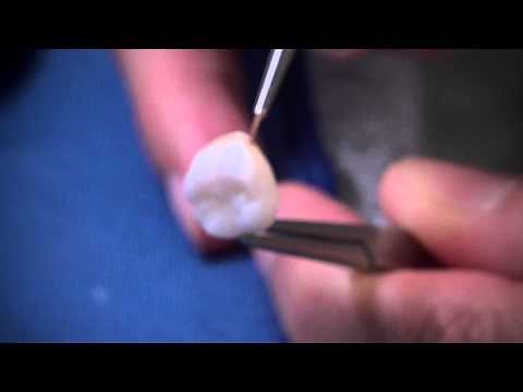 GC Initial IQ Lustre Pastes Application Technique 3 with Masayuki Hoshi