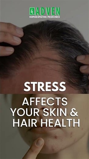 Stress Showing on Your Skin? Heal from Within 🌿