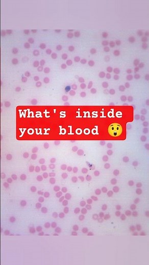 Blood Smear Preparation 🔬 #bloodsmear #blood #microscope #biology #zoology #experiment #lab