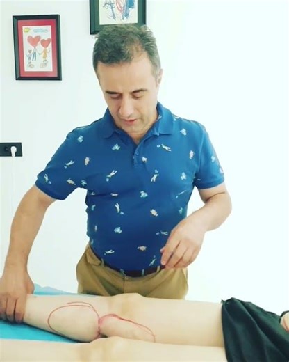 Çarpık Bacak Bilgilendirme - Prof. Dr. Ayhan Okumuş
