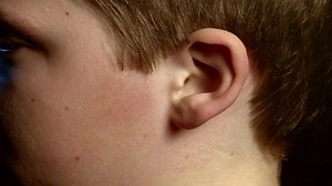 The ageing process: What happens to our ears over time?
