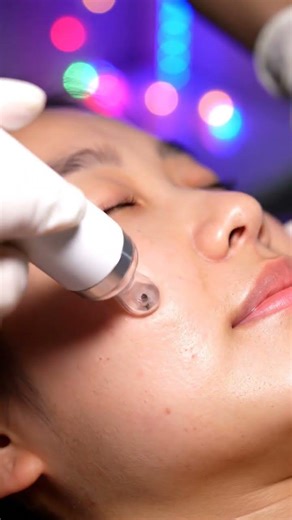 Every Pore Cleared | cheek Vacuum Blackhead Removal (4K ASMR)3