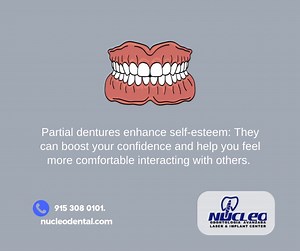 Partials are a better option than full dentures for replacing lost teeth on the lower jaw. Contact us for more information about our dentures service. . Phone: 915 308 0101 nucleodental.com . #NucleoDental #dentalclinicnearme #dentaltourismmexico #dentalimplantsjuarez #bestdentalserviceintown #dentalservice #elpasotexas | Nucleo Dental