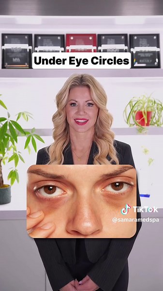 Quick Solutions for Common Skincare Problems