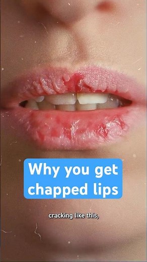 Why do your lips get chapped?