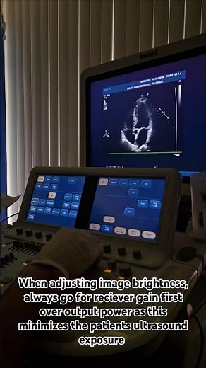 The ALARA Principle in Ultrasound