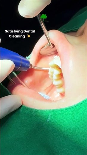 Professional Teeth Scaling | Oaks Dental Clinic Korea