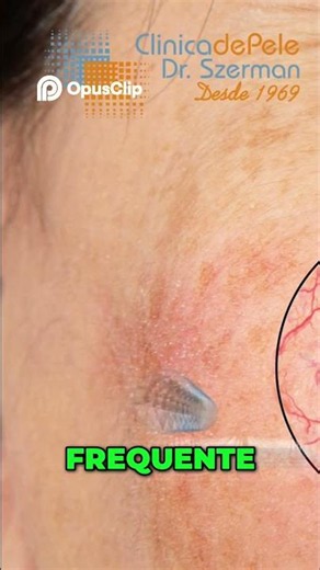 Rosácea: o que ninguém te conta 😳 + como controlar os sintomas ✨