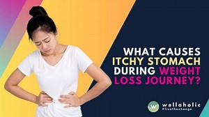 What Causes Itchy Stomach During Weight Loss Journey?