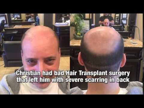 Bald Guy Gets A Hair Tattoo