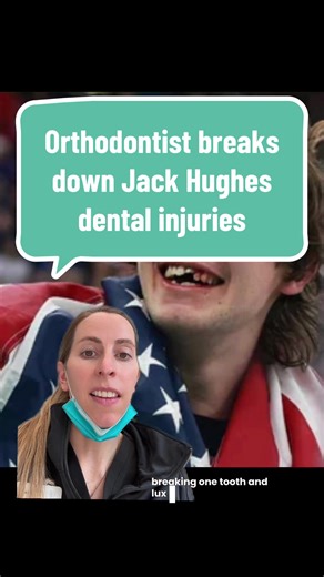 Would you keep playing if this happened to your tooth? 😬 #jackhughes #dentaltok #orthodontics #orthodontistsoftiktok #twinsmilesortho