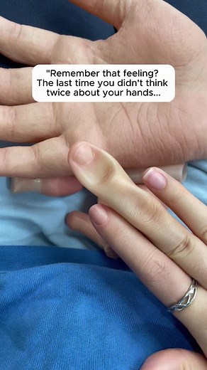 #siliconeprothetic #fyp #handprothesis #proteza #silikon