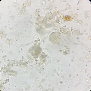 73K views · 998 reactions | Stool sample ❤️❤️ | Lab life | Facebook