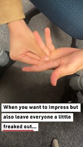 Magician Breaks Off Fingers #magic #magician #magictricksvideos | Reader's Digest