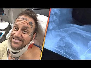 Jelly Roll HOSPITALIZED After Flipping ATV in Terrifying Crash