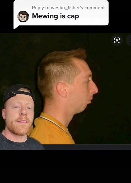 Improving Jawline and Breathing with Mewing Technique