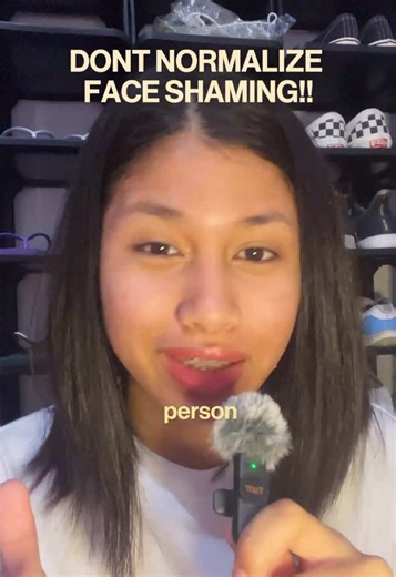 Stop normalizing Face Shaming! #acne (Acne talk)