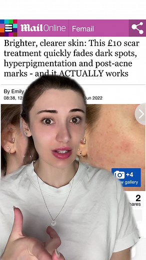 Inkey List Mandelic Acid Treatment Review