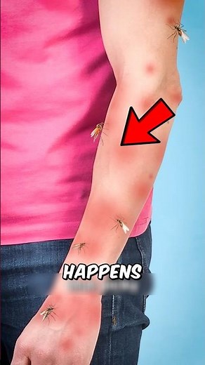 Mosquito Bite? DON’T Scratch It 😳🦟
