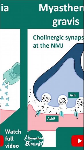 Myasthenia gravis | Pathology in 1 minutes | USMLE step 1
