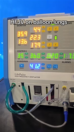 Josh BSRT, RRT-NPS on Instagram: "High Frequency Jet Ventilator . #respiratorytherapist #respiratorycare #ventilator #lungs #fyp"