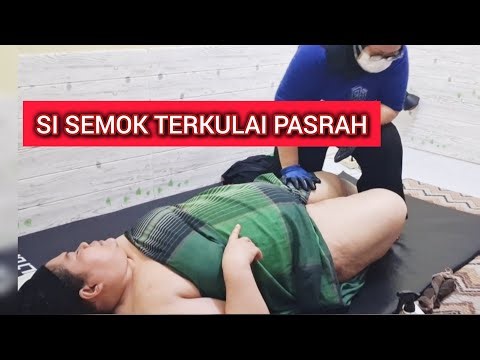 SI SEMOK TERKULAI PASRAH