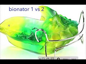 Bionator 1 vs Bionator 2- Bionator Design