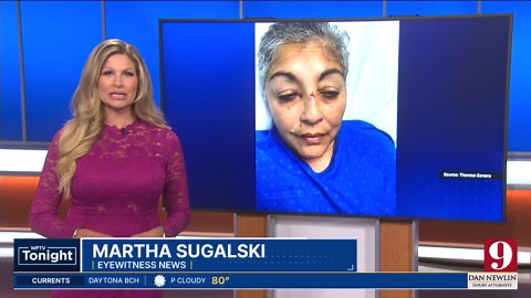 ‘Why me, what did I do?’: Woman dragged during robbery speaks out