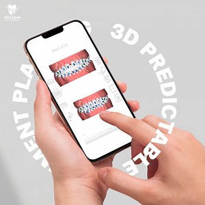 สแกนฟันแบบ 3 มิติ✨ จัดแผนการรักษาได้อย่างแม่นยำ เห็นผลลัพธ์ได้ทันที 💙อยากจัดฟันใสบ้าง? ลองทำเเบบประเมินฟันฟรี Link นี้ หรือใน Bio ได้เลย 👉🏻 https://www.drclearaligners.co.th/th/free-smile-assessment/ __________________ ติดตามเราได้ที่ Facebook : Dr Clear Aligners Thailand Instagram : drclearalignersthailand Line : @drclearaligner #drclearaligners #smilemore #invisiblealigners #smilebetter #clearaligners #invisiblebraces #จัดฟันใสพรีเมี่ยม #จัดฟันแบบใส #จัดฟัน #จัดฟันใสราคาไม่แพง #จัดฟันใสแก้ไ