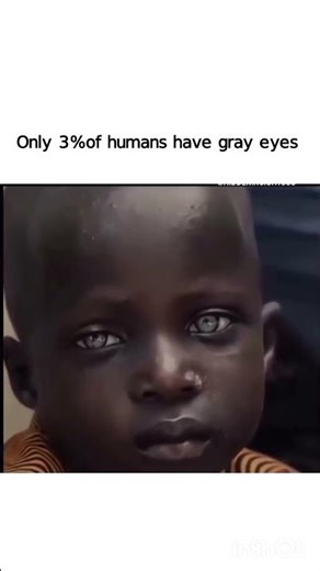 The Rarity of Gray Eyes