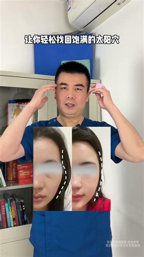 Charming Cheekbones: Discover the Secret to Flawless Faces