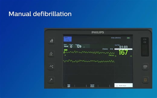 （生肉）飞利浦 HeartStart Intrepid 除颤监护仪使用教学视频 — 6、手动除颤