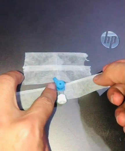 How to Secure an IV Cannula | IV Cannulation Procedure #ivline #hospital #cannulation #cannulation